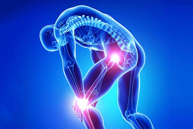 alt="Musculoskeletal pain muscle pain and joint pain"